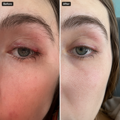 EaseBlink Thermal Clearing Mask