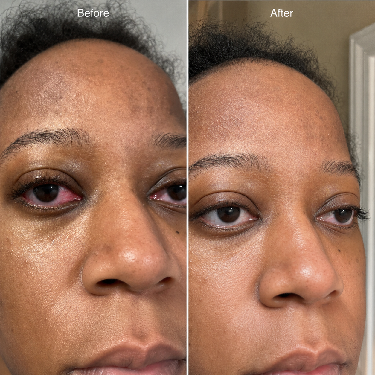 EaseBlink Thermal Clearing Mask