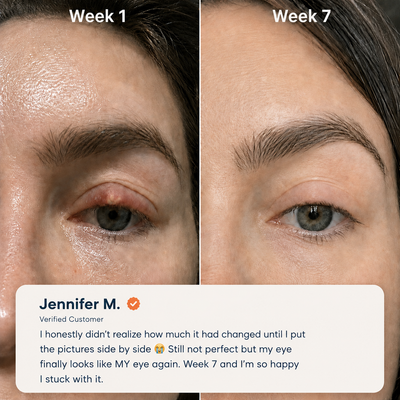 EaseBlink Thermal Clearing Mask