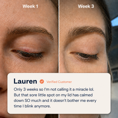 EaseBlink Thermal Clearing Mask