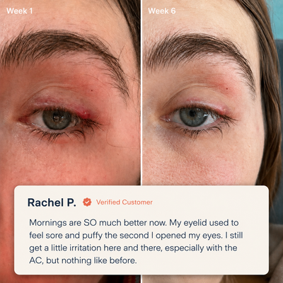 EaseBlink Thermal Clearing Mask