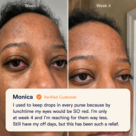 EaseBlink Thermal Clearing Mask