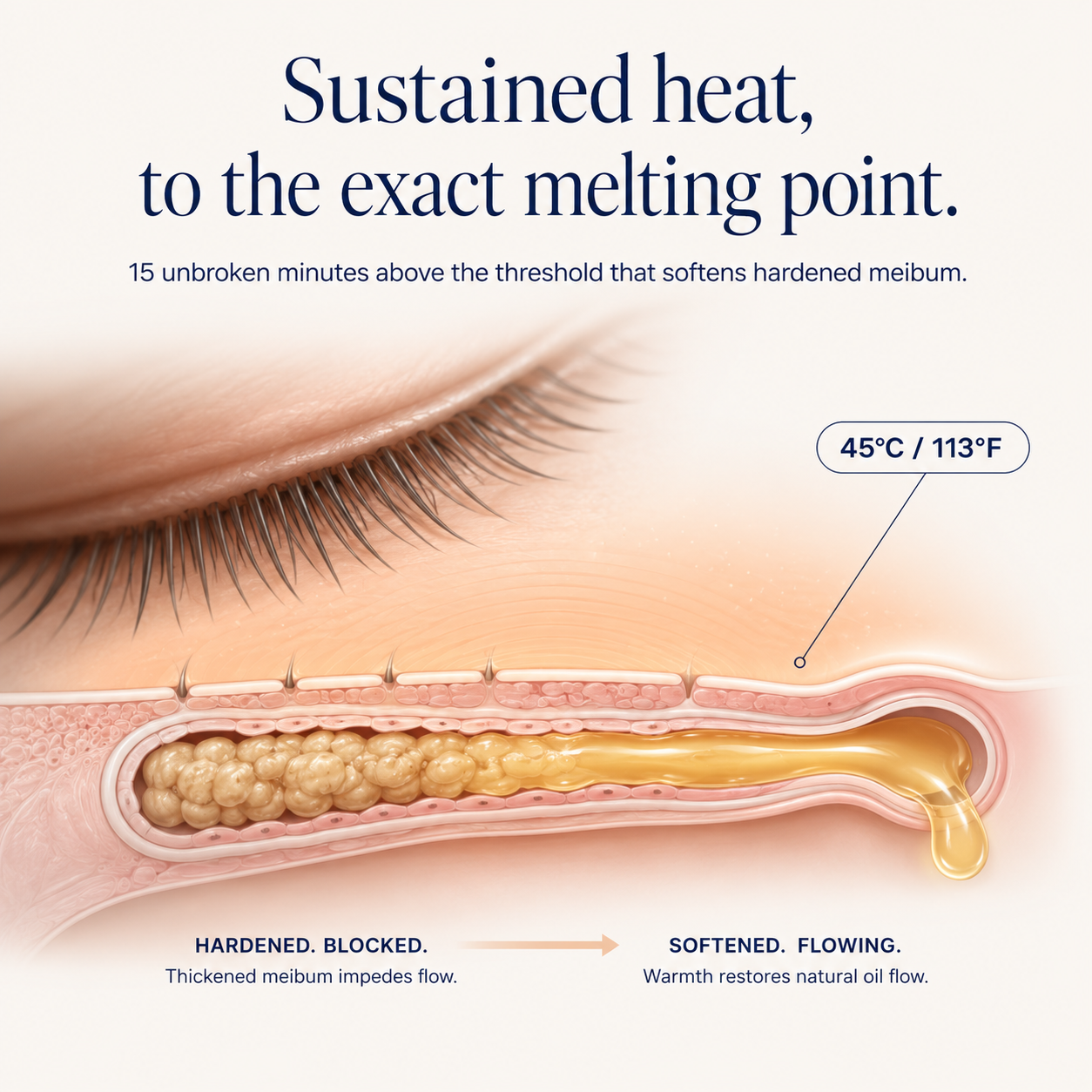 EaseBlink Thermal Clearing Mask